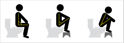 Series of three graphics showing the appropriate posture on the commode for elimination.