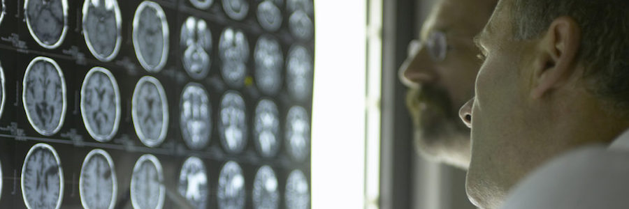 Two doctors assess a patient's brain scan.