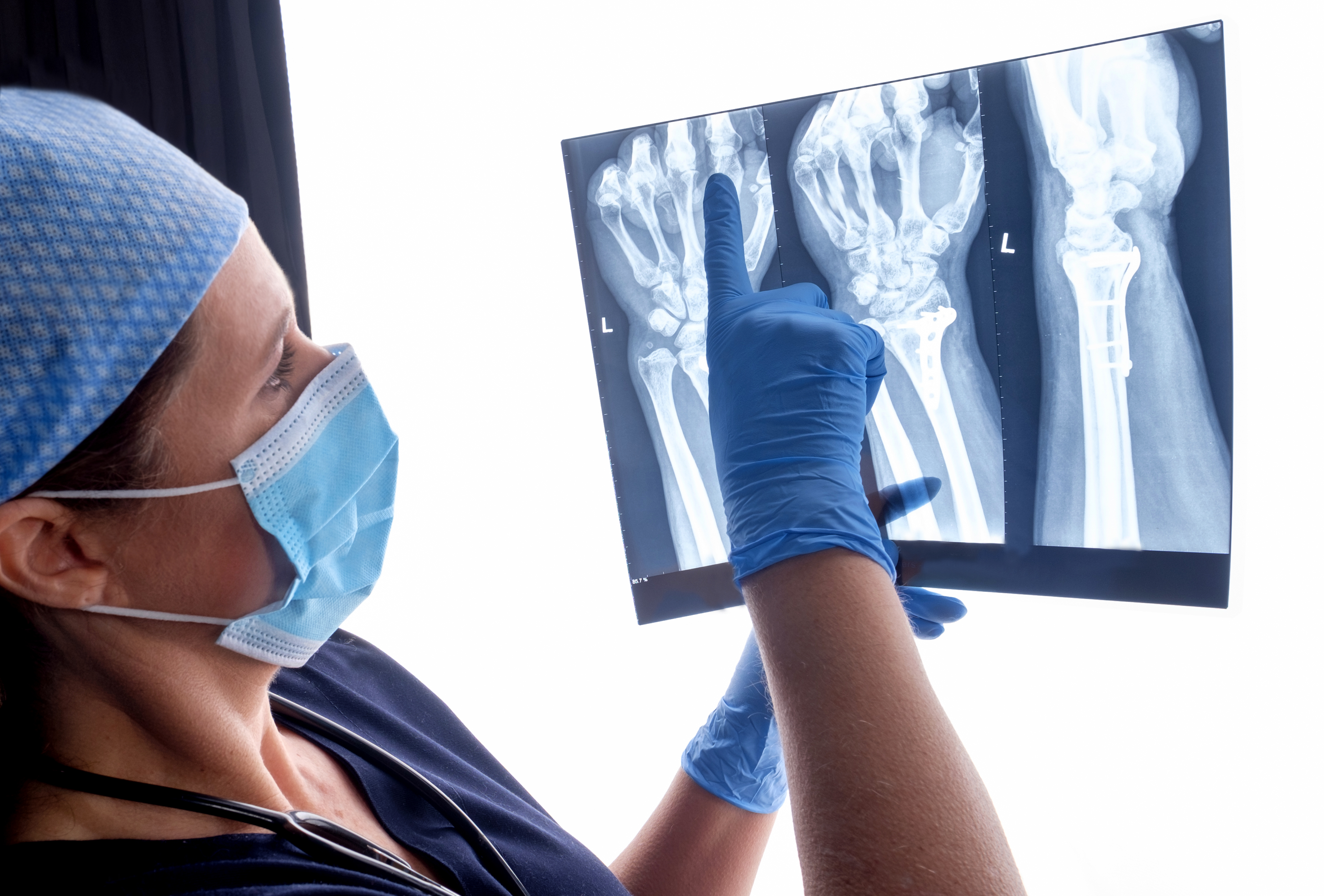 Hand injury image
