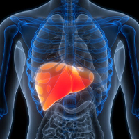 liver cancer risks