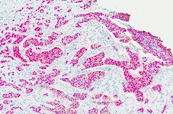 immunohistochemistry