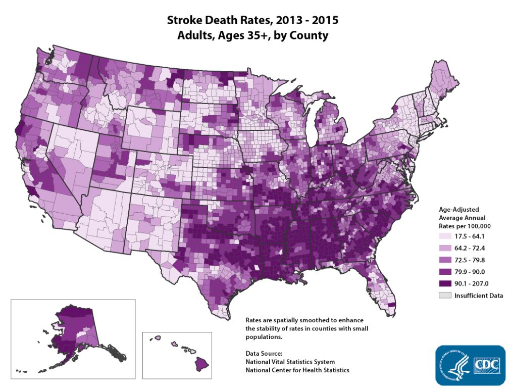 Stroke Death Rates 2013-2015 by U.S. County showing prevalence of stroke in Kentucky; up to 207 deaths per 100,000 in many counties.