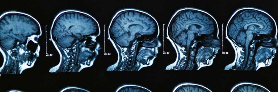 An MRI of the human brain.