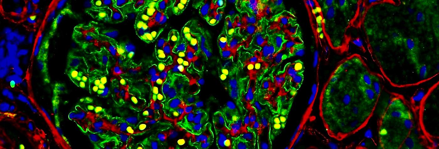 Photo by Andrew Shinkle, A multiplex IF image of a human kidney glomerulus.