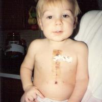 Scanned photo of Dr. Kyle Riggs as a toddler, with his surgical scare down his chest visible