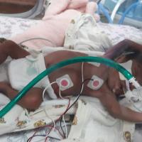 A photo of an infant Betty in her hospital bed. There are several monitors that are connected to her.