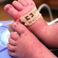 This image shows Henry’s feet when he was a baby. One foot has a bandage with writings on it.