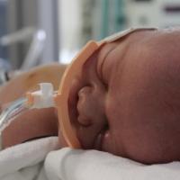 Baby Henry lays on a hospital bed with a breathing cannula attached to him and multiple medical equipment behind him.