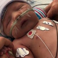A close-up of Jeremiah in the NICU after he was born. He is being given oxygen through a tube and has several monitors attached.