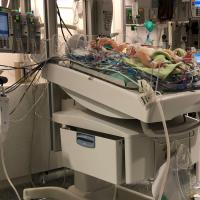 Jeremiah sits in a bassinet at the hospital while hooked up to several machines. He is laying on top of several blankets while surrounded by tubes and wires.