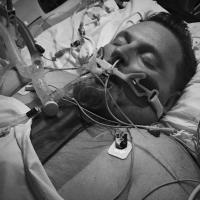 Black and white photo of Jimmy unconscious and hooked up to lots of medical equipment to keep him alive.