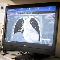 The computer screen displays the scan of a patient's heart as it is being monitored.